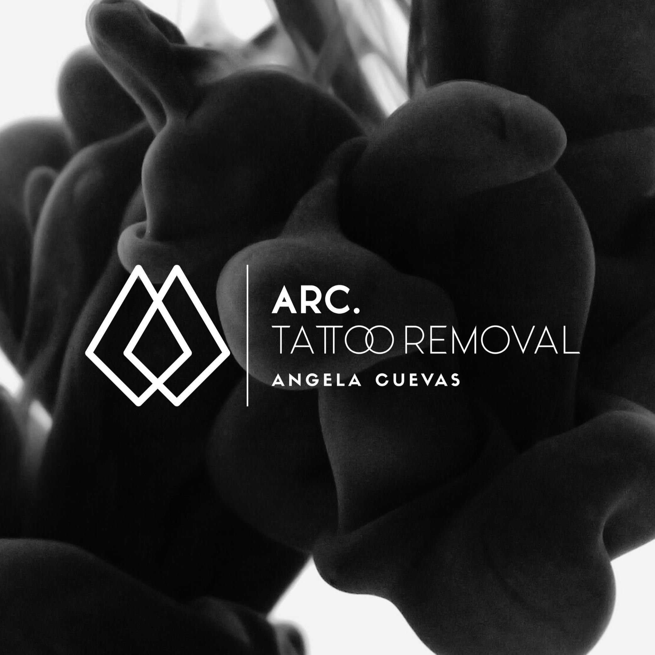 ARC TATTOO REMOVAL, Avenida del Doctor Fleming, 21, 14004, Córdoba