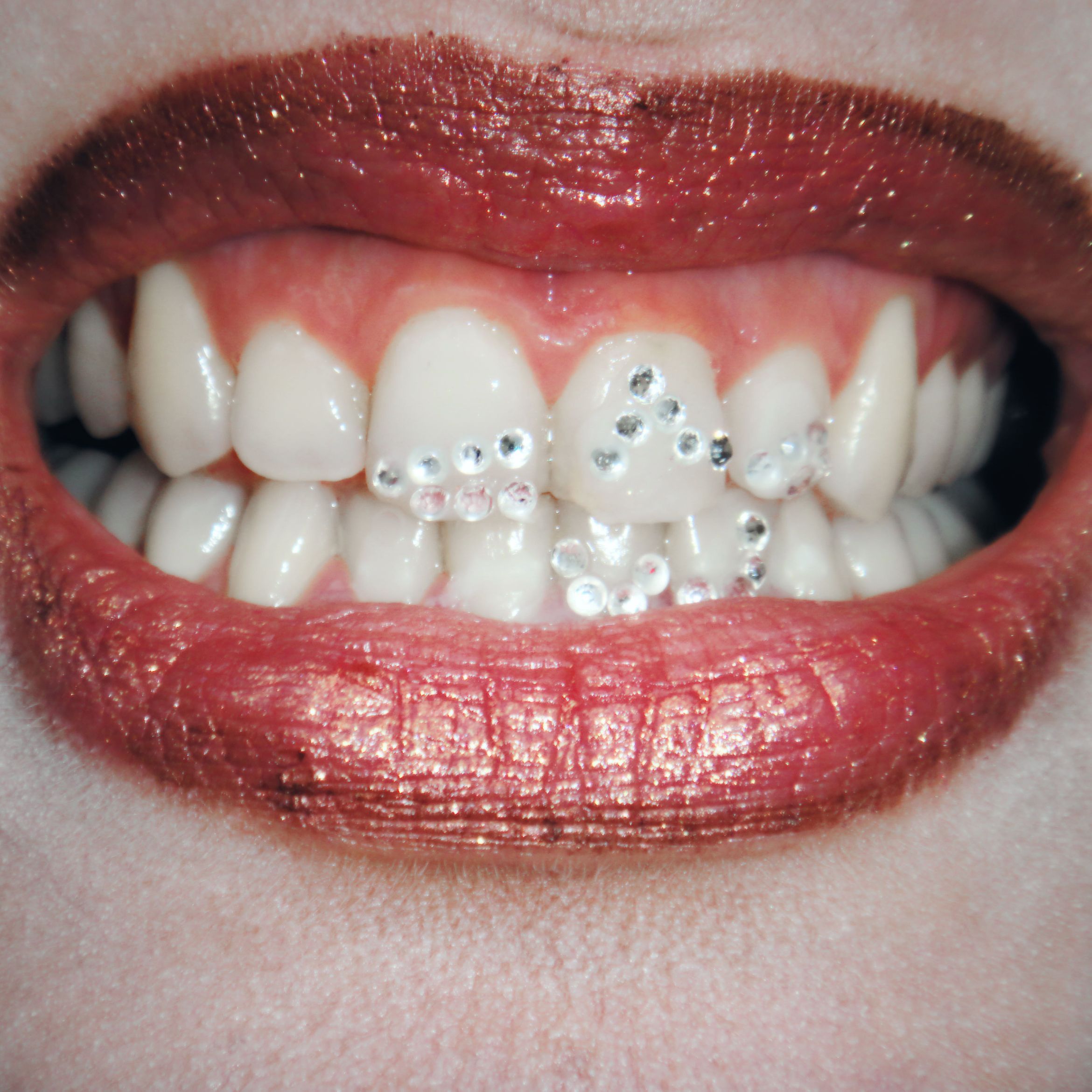 Santagemzzz | Tooth Gems | Gemas Dentales, Calle del Conde de Romanones, 10, Studio 044, 28012, Madrid