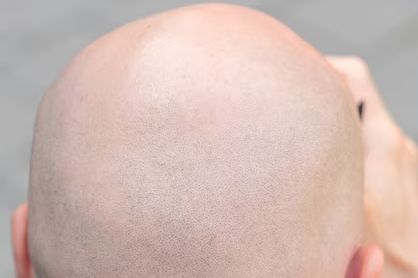 Afeitado de cabeza [Shaver] portfolio