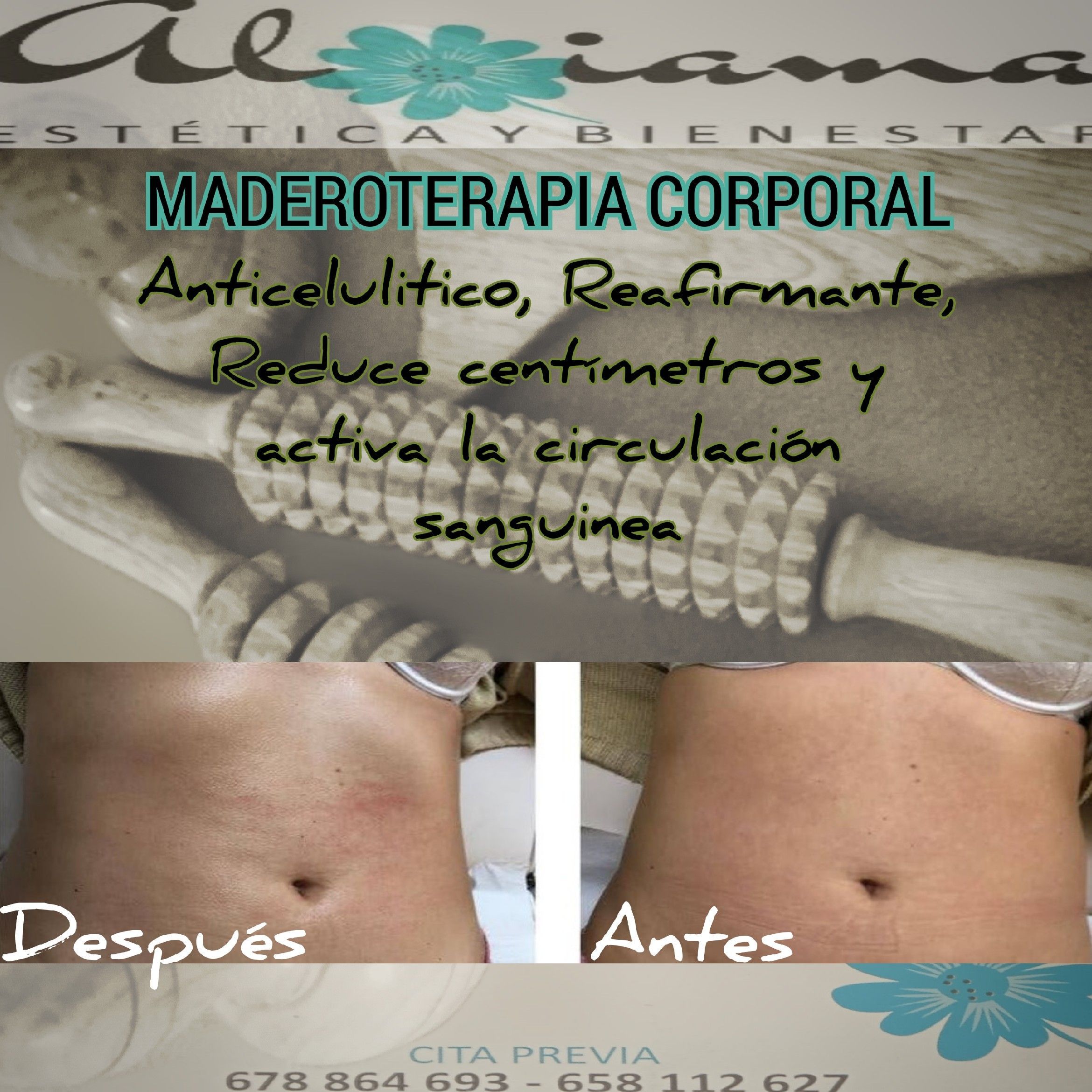 Maderoterapia Corporal portfolio