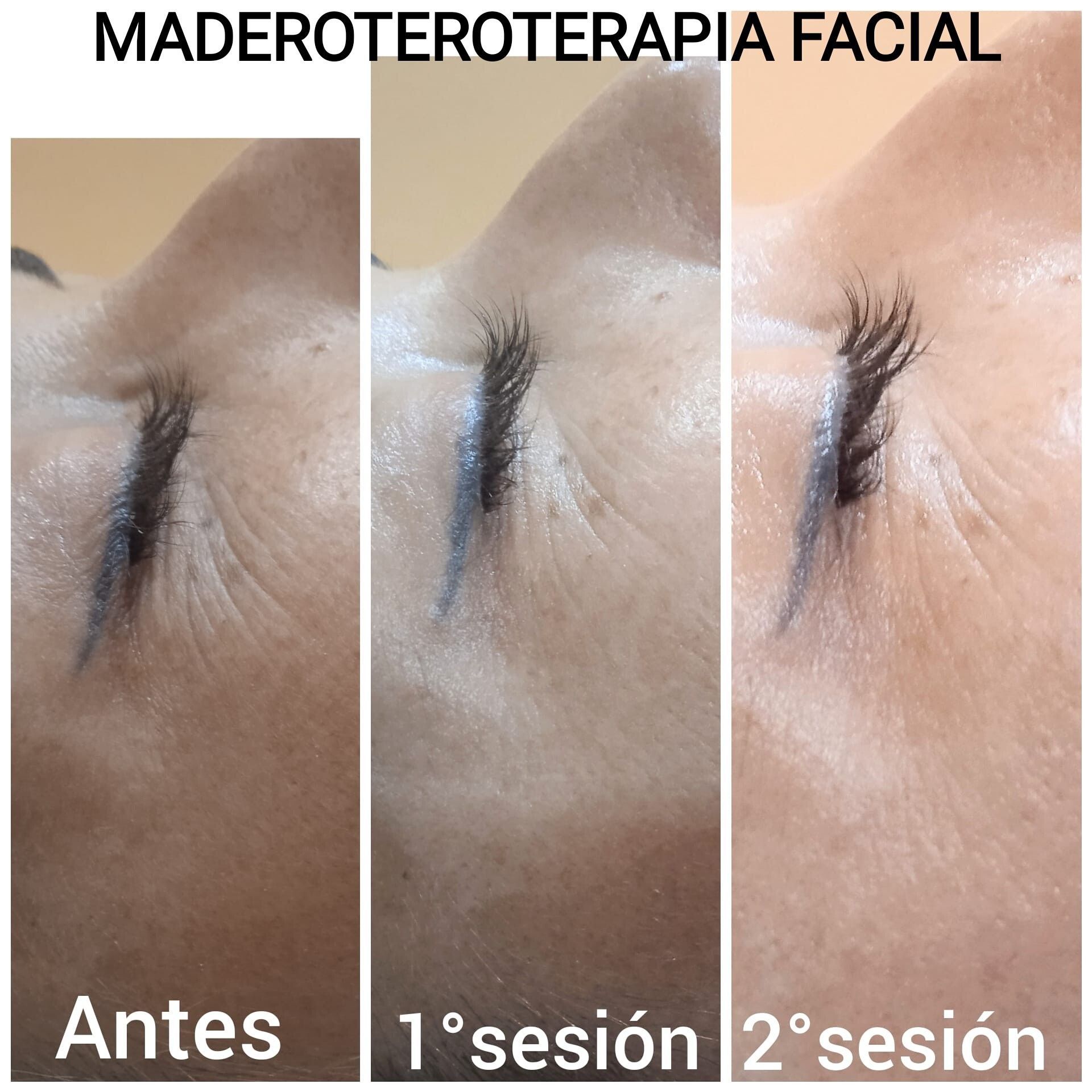 Bono6 Maderoterapia Facial portfolio