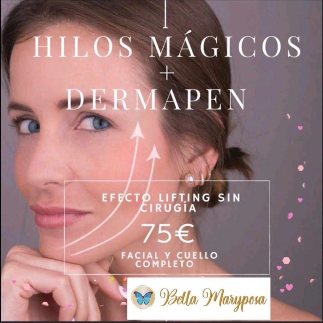 Lifting Sin Cirurgia. Hilos magicos + Dermapen portfolio