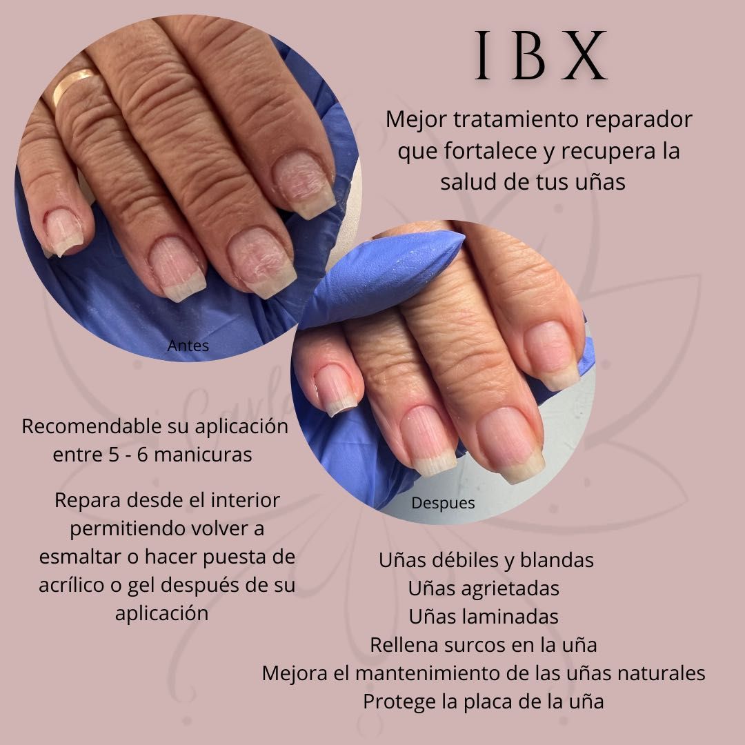 Tratamiento IBX portfolio