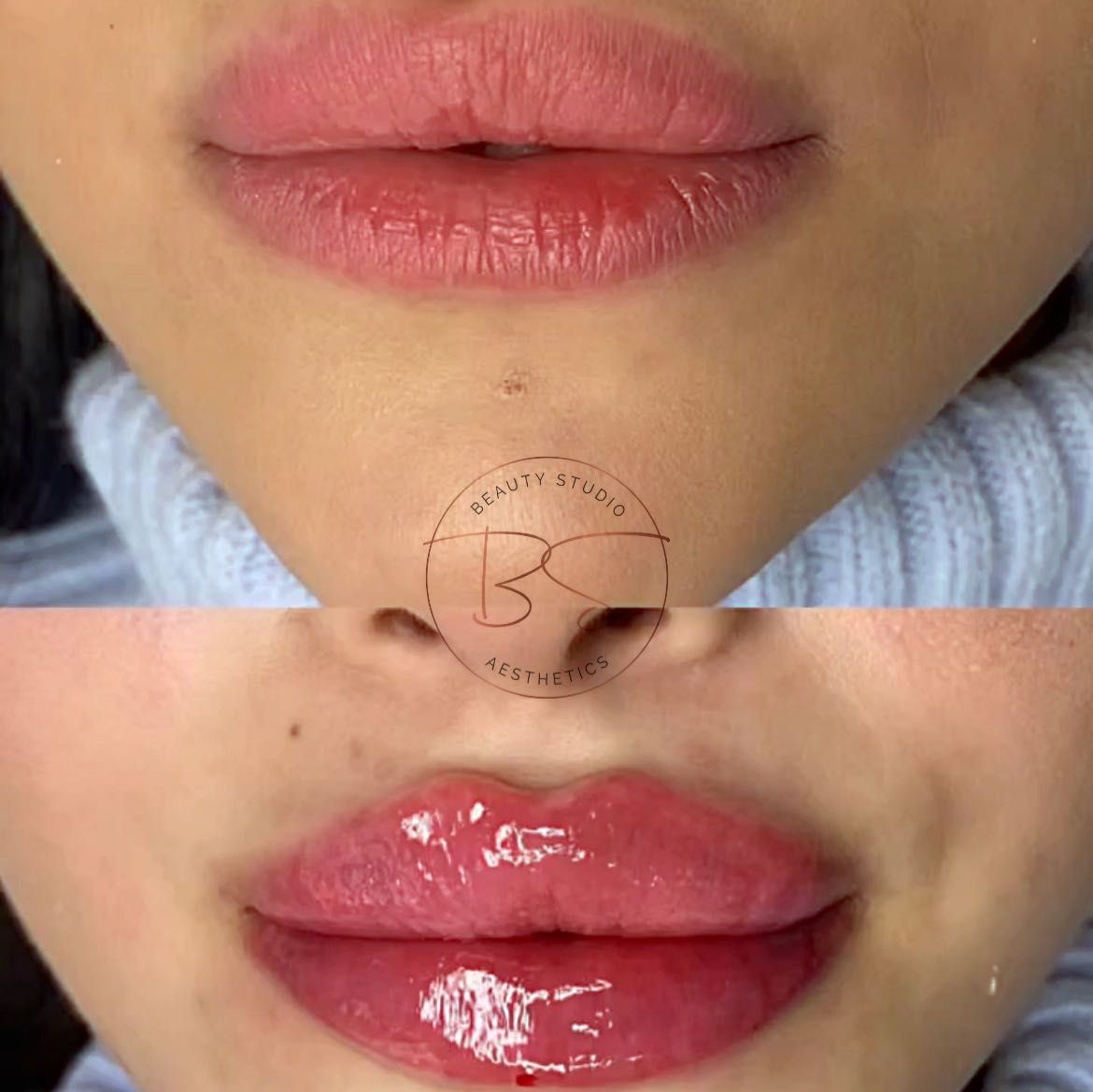 Porfolio de Lèvres / Russian Lips