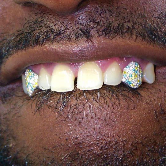 grillz diamant personnalisé