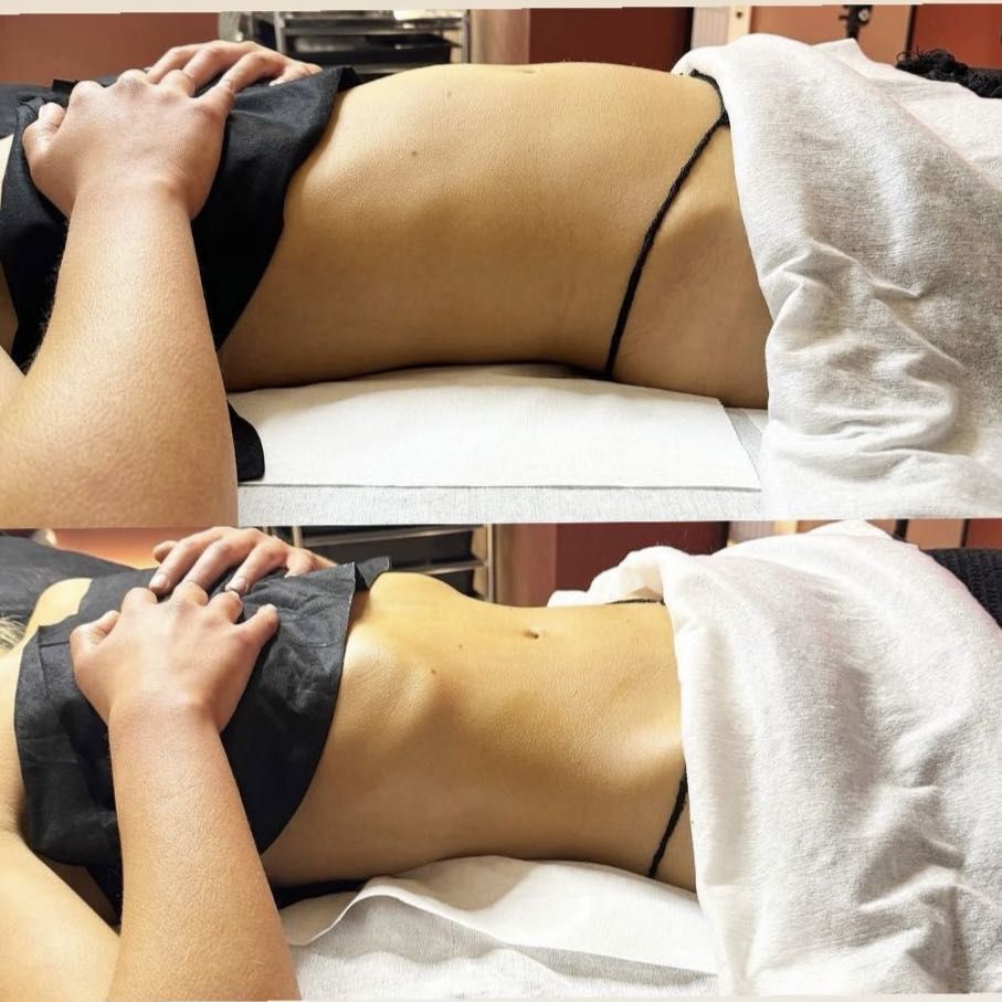 Full Body Lymphatic Drainage Massage portfolio