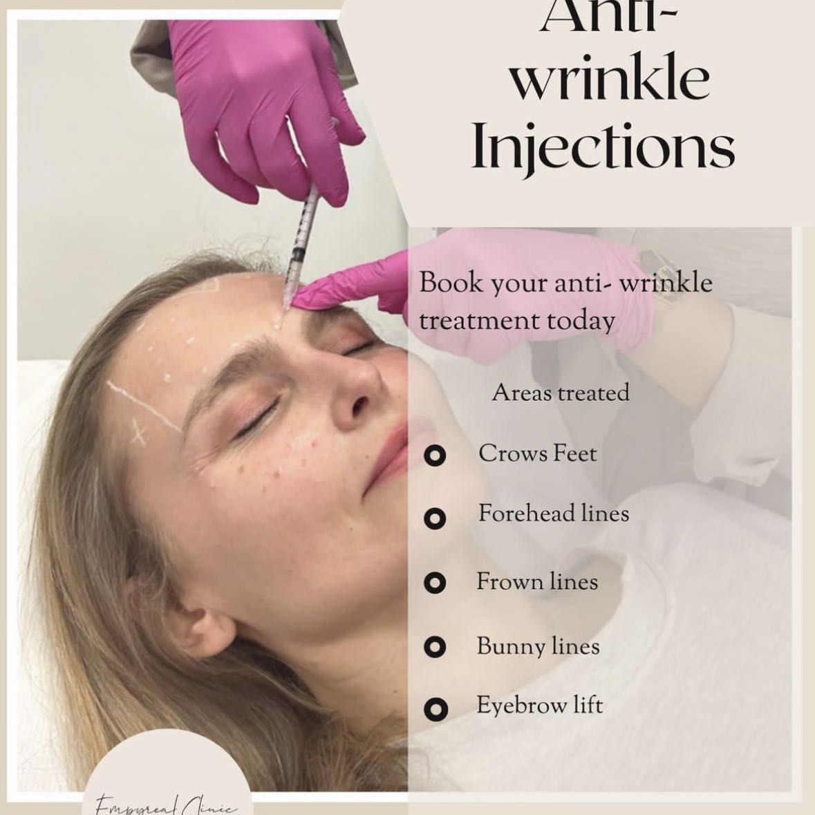 Anti-Wrinkle Injections portfolio