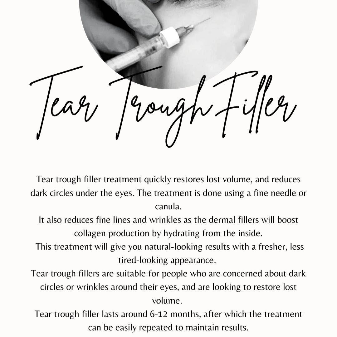 Tear trough filler treatment portfolio