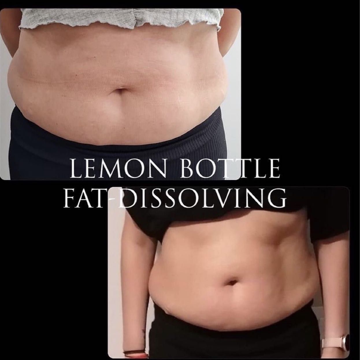 Lemon Bottle Fat Dissolve Inner Thighs portfolio