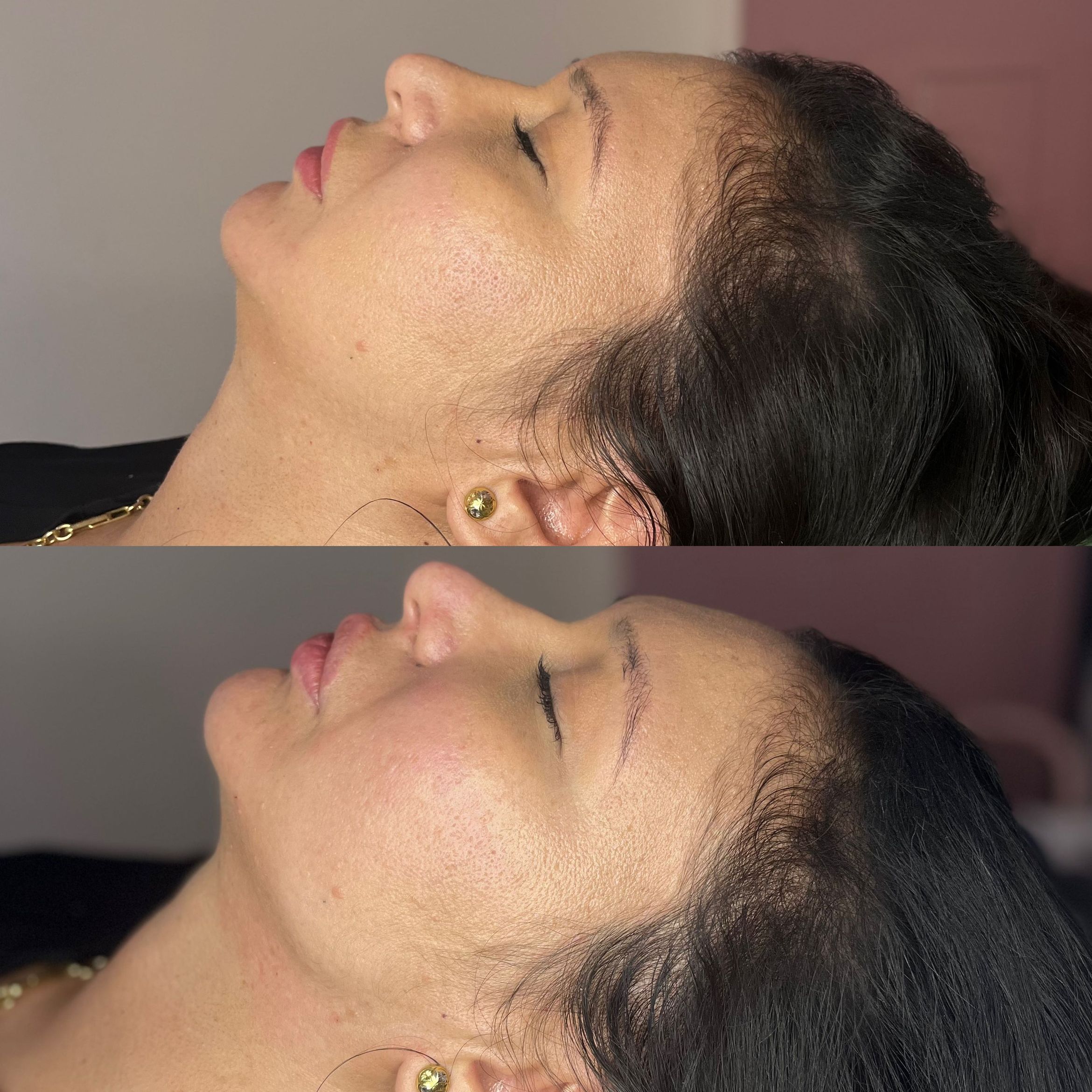 4ml natural face contouring package. portfolio