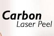 Carbon Peel portfolio