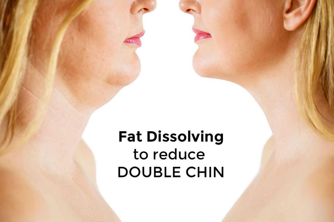 Fat Dissolving - Chin portfolio