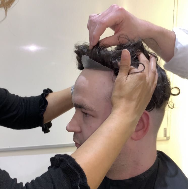 Full Hair Replacement Fitting Service portfolio