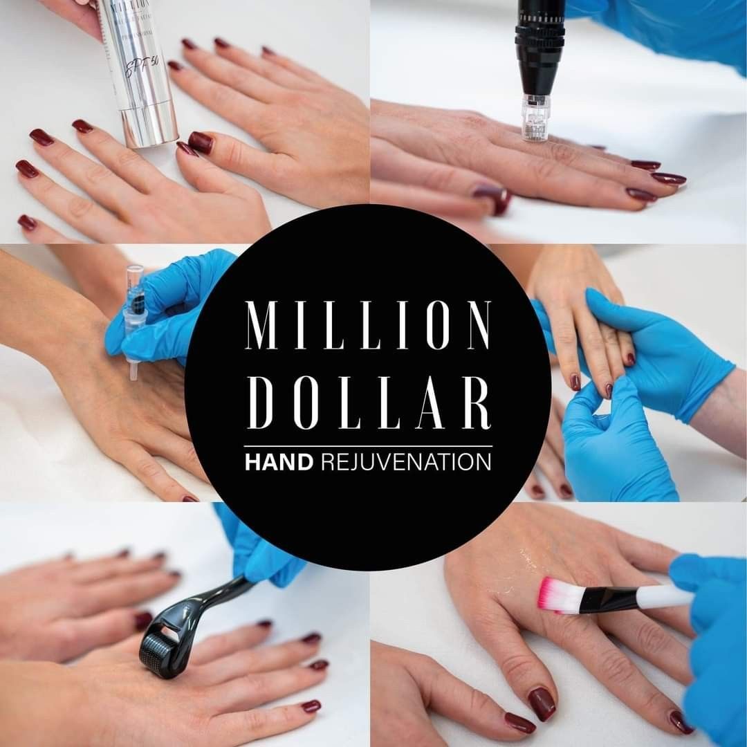 Million Dollar Hand Rejuvenation portfolio
