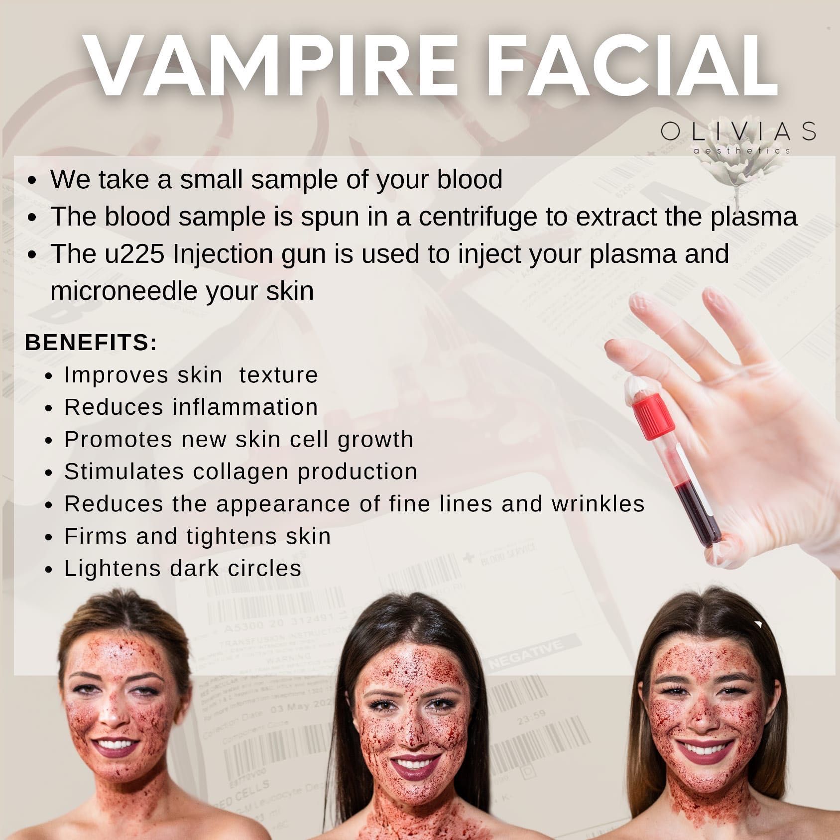 Vampire facial (PRP facial) includes neck & chest portfolio