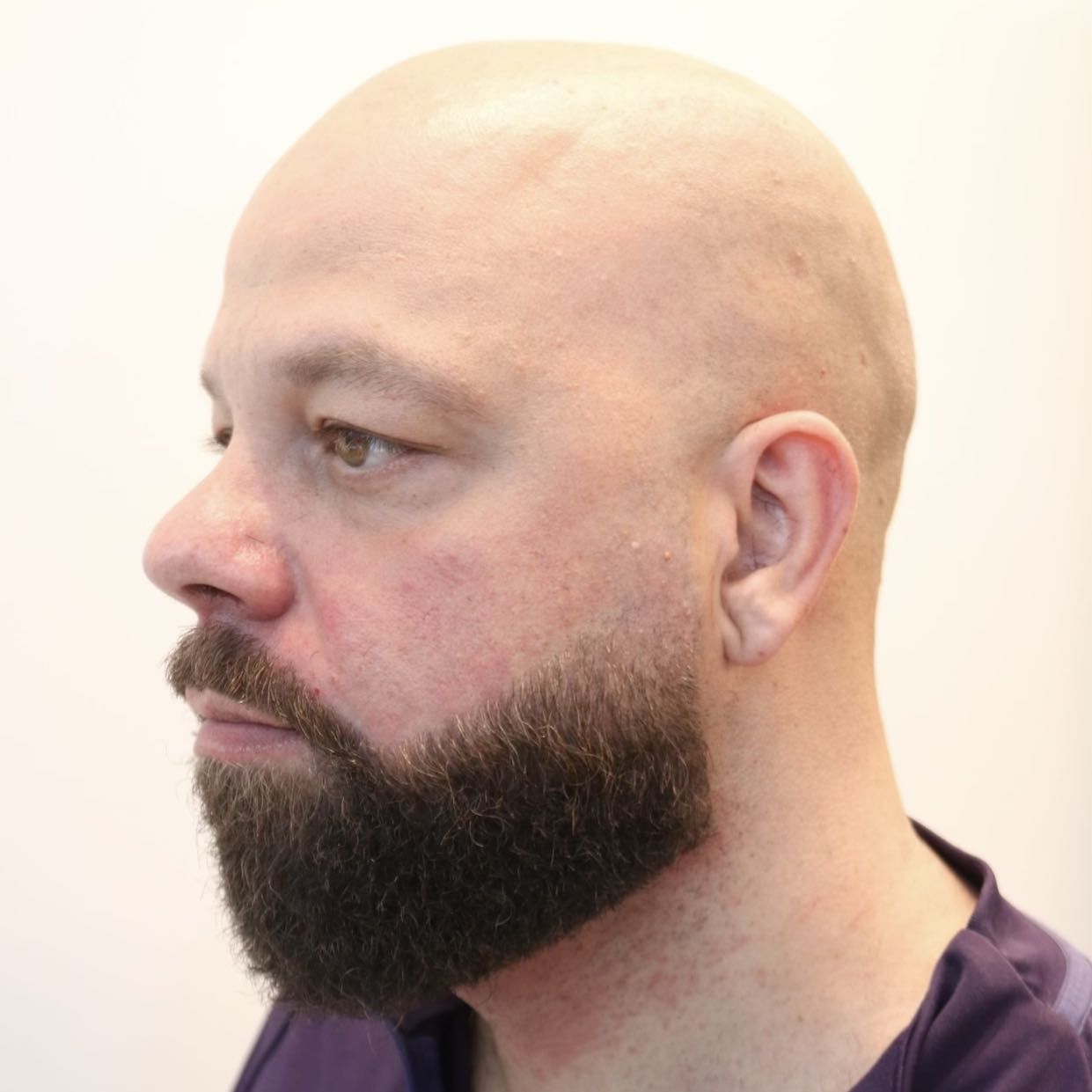 Head shave and Beard trim portfolio