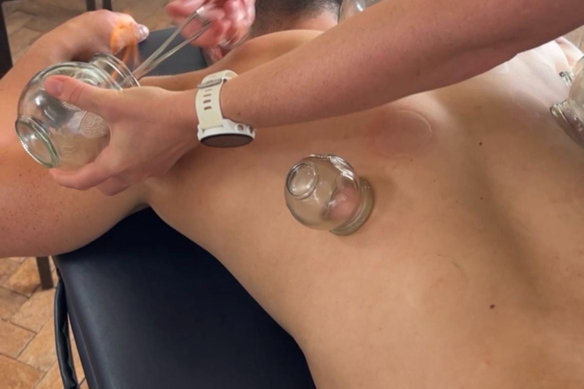 Fire Cupping Therapy portfolio