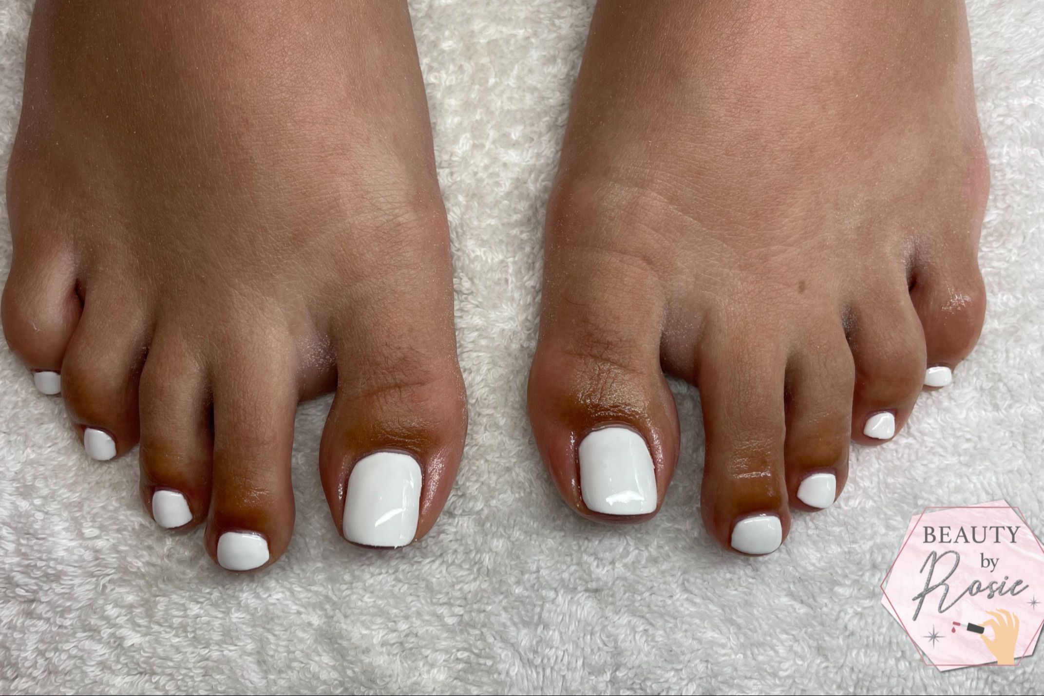 Gel Toes WITH REMOVAL portfolio