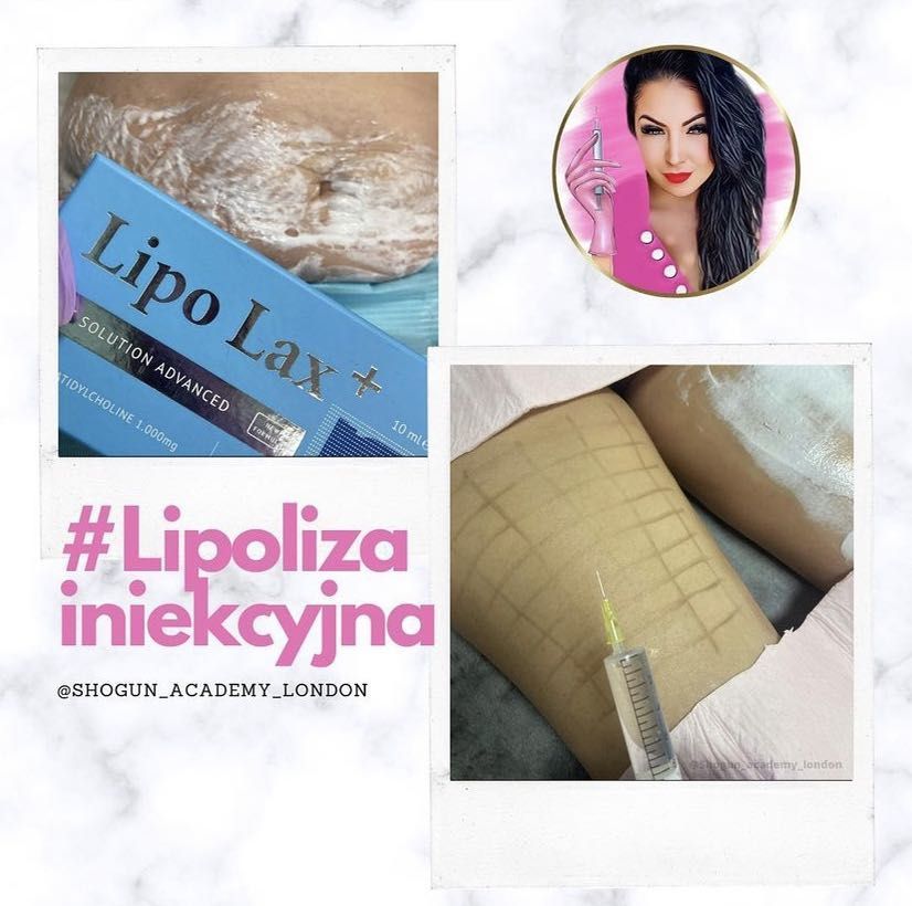 Fat dissolving small | Lipoliza iniekcyjna small 💉 portfolio