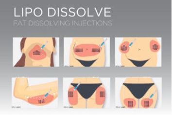 Fat Dissolving / Lipolysis | 1 Area portfolio
