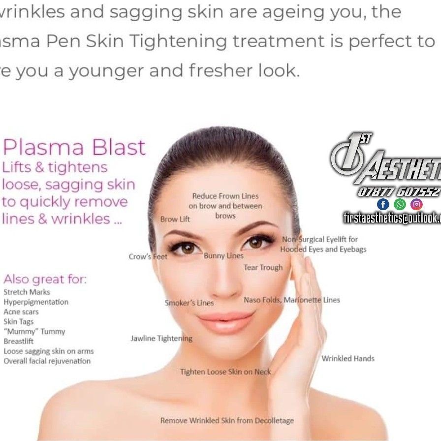 Fibroblast plasma - skin tightening portfolio