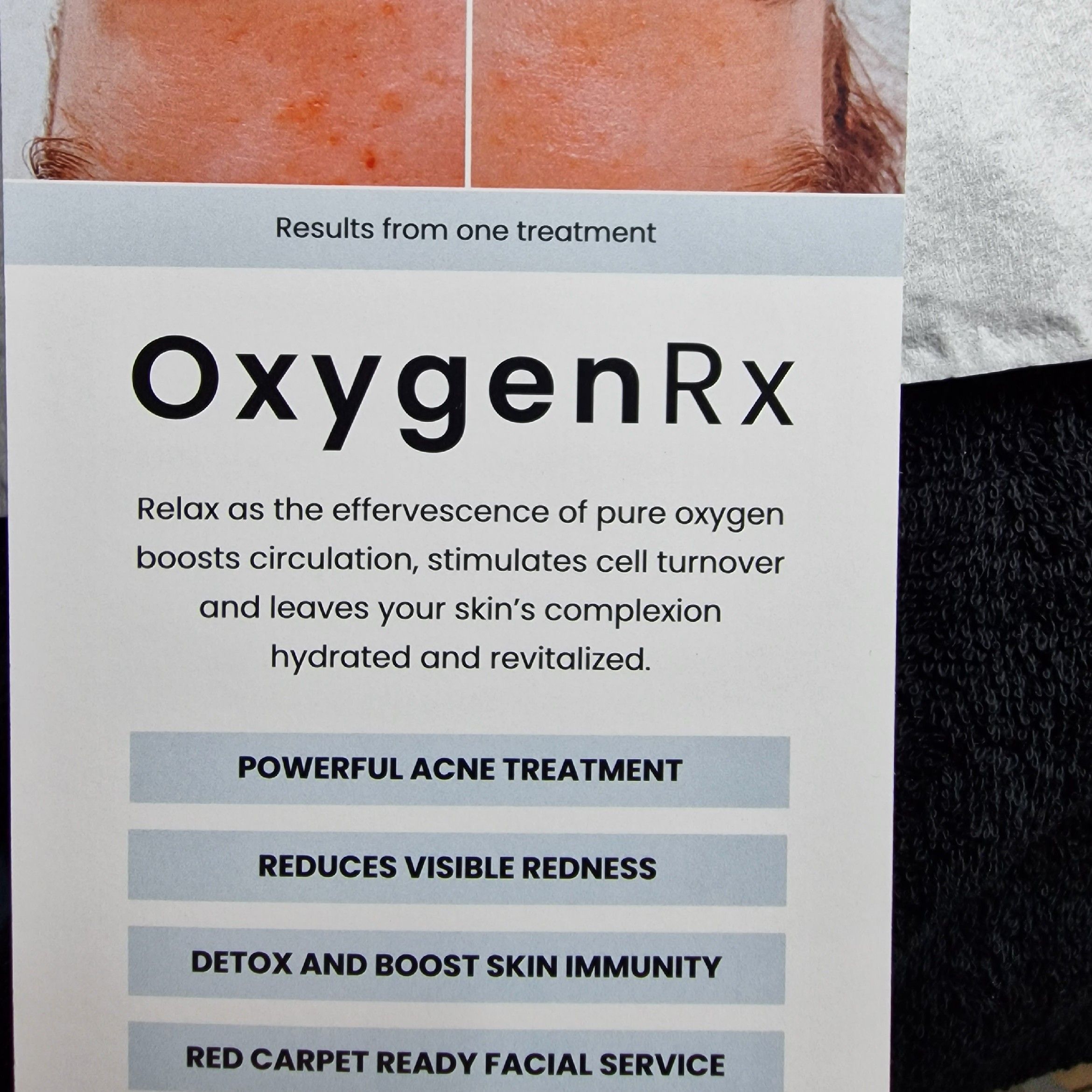 Holistic Bespoke Facial/Oxygen RX Treatment portfolio