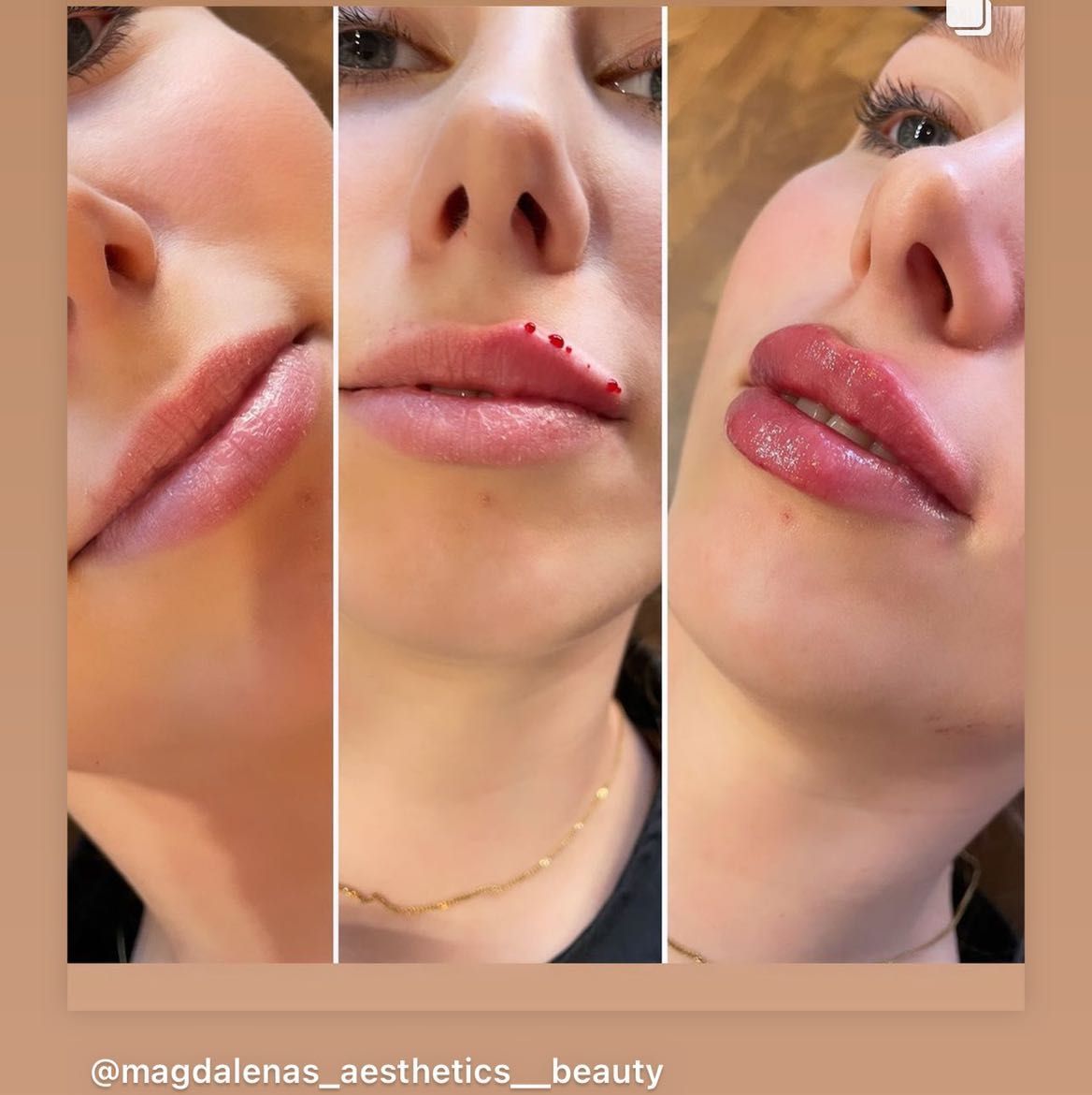 Russian lips portfolio