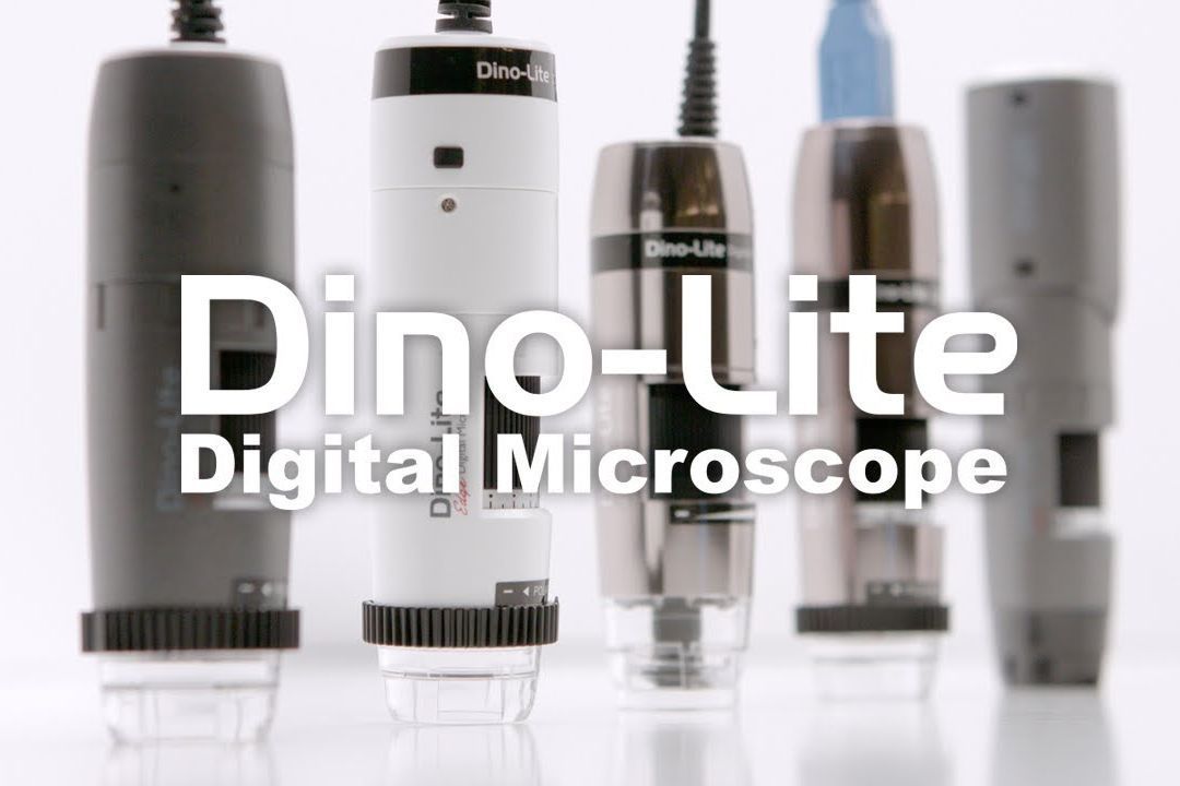 Scalp consultation with Dino Light Microscope portfolio