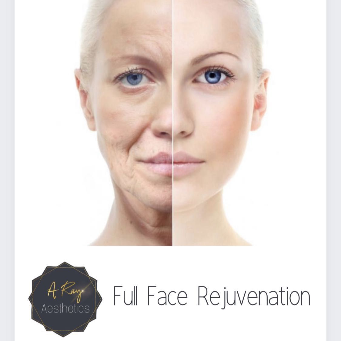 Full Face Rejuvenation portfolio