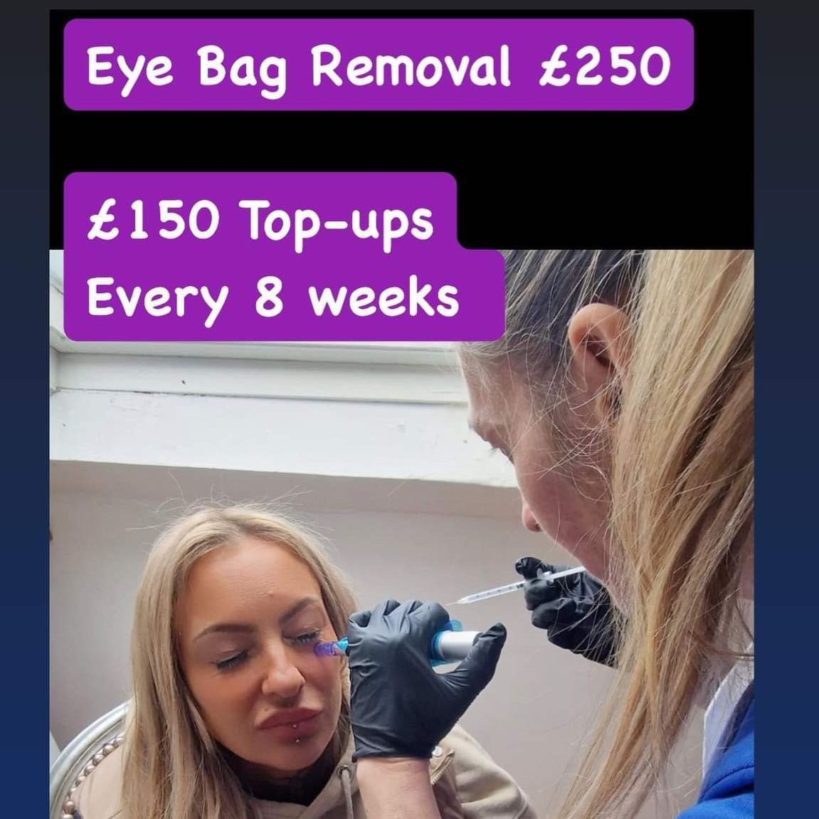 Eyebag Removal Rejuvenation portfolio