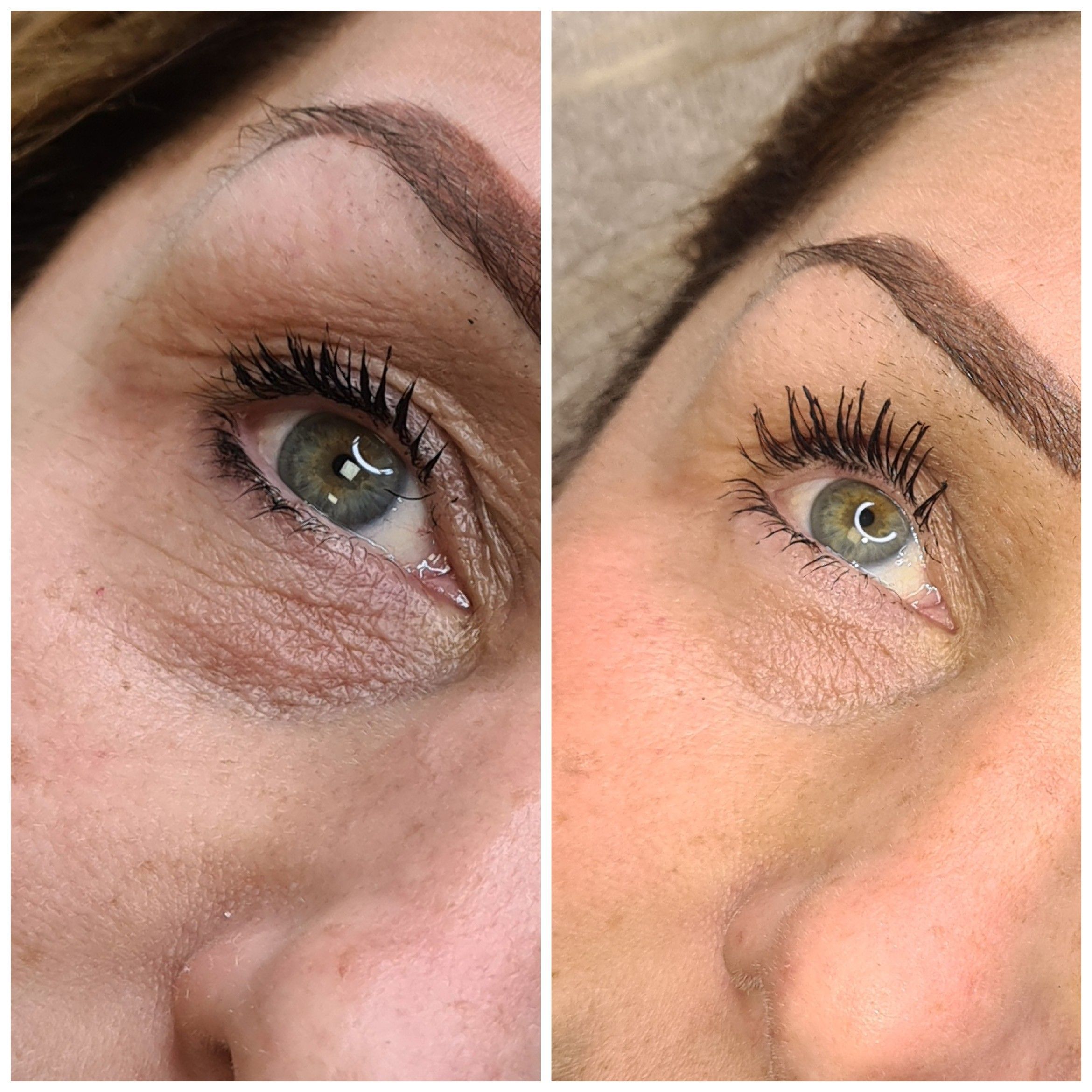 Lumi Eyes, 3 Treatments..over 6 Weeks.Usually £450 portfolio