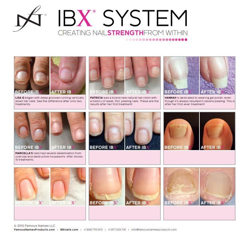 IBX nail treatment portfolio