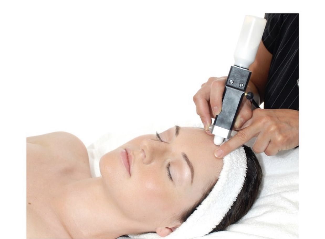 Microdermabrasion with face lift portfolio
