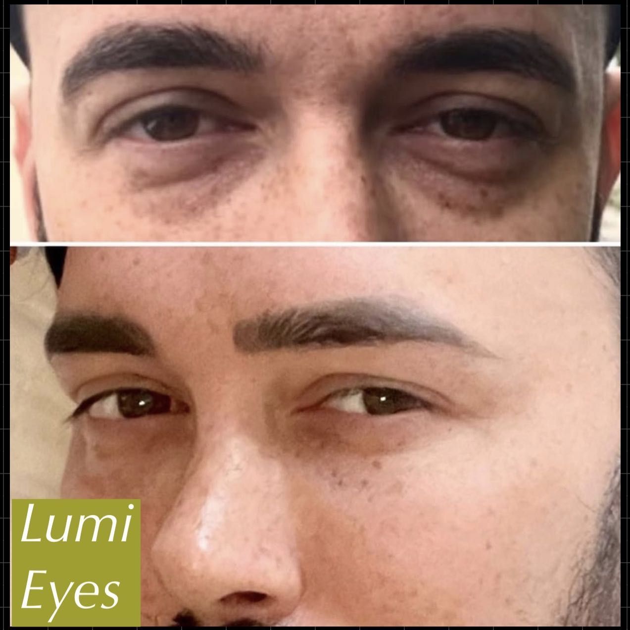 Under eyes - Lumi eyes alternative portfolio
