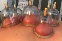 Dry Cupping Therapy portfolio