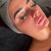 Facials By Kayley Eclipse Aesthetic - Chloe’s Uk