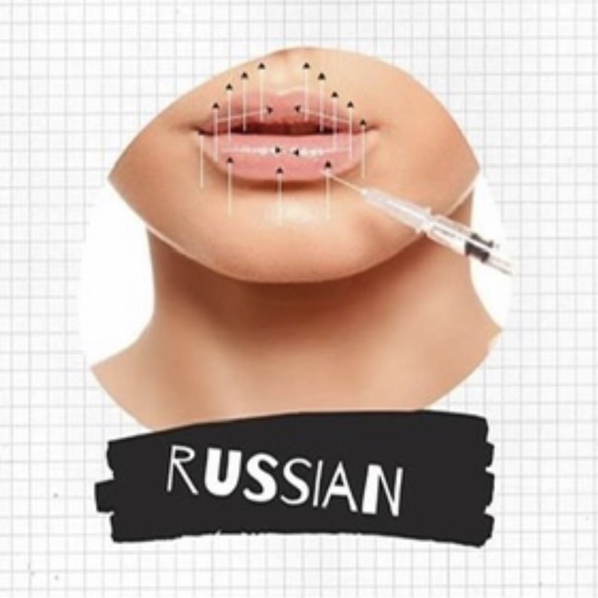 1ml Russian/ standard lip fillers Revolax portfolio