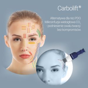 Portfolio usługi Carbolift cała twarz