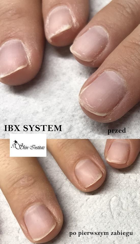 Portfolio usługi IBX- regeneracja paznokci