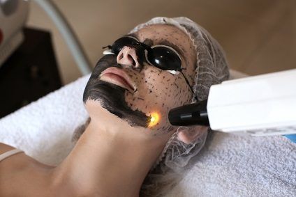 Portfolio usługi Peeling węglowy twarz