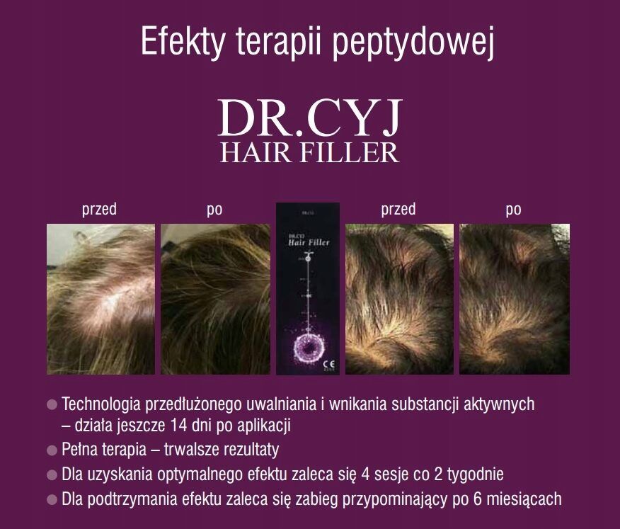 Portfolio usługi Dr Cyj zabieg peptydowy na skórę głowy/włosy