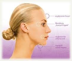 Portfolio usługi Mezoterapia bezigłowa twarzy i szyi