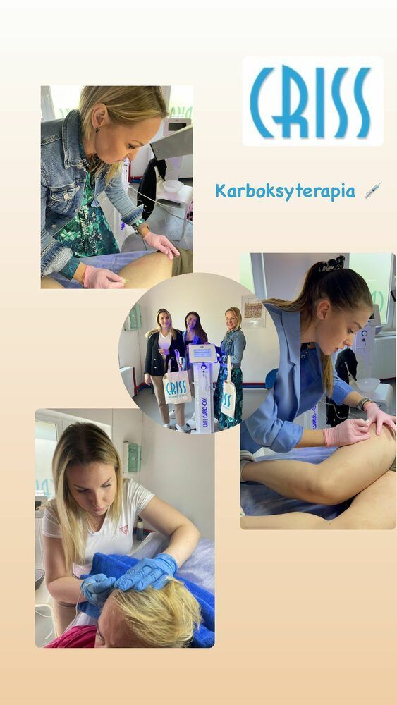 Portfolio usługi Karboksyterapia