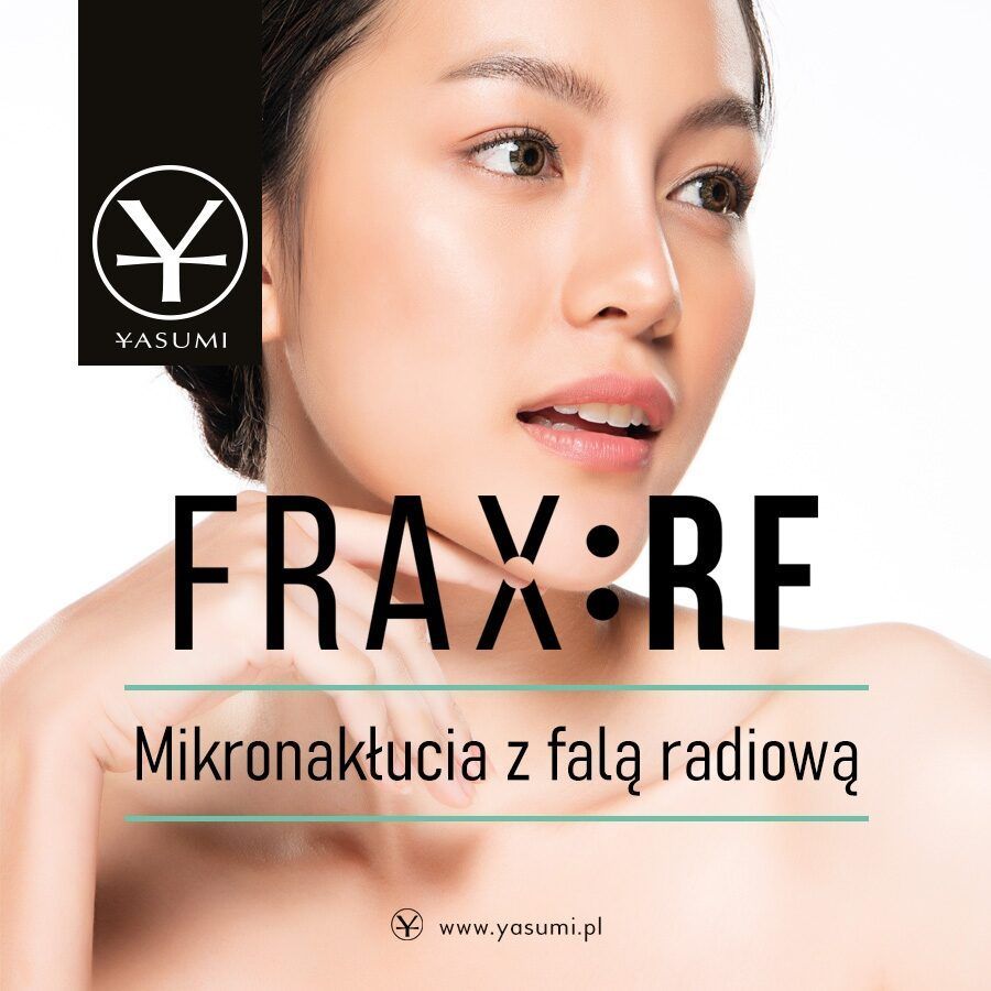 Portfolio usługi Frax:RF - mikronakłucia z falą radiową