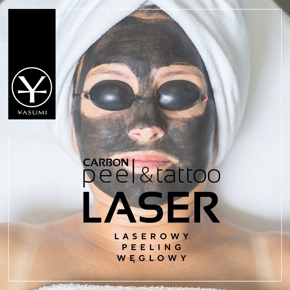 Portfolio usługi Carbon Peel - laserowy peeling węglowy twarzy