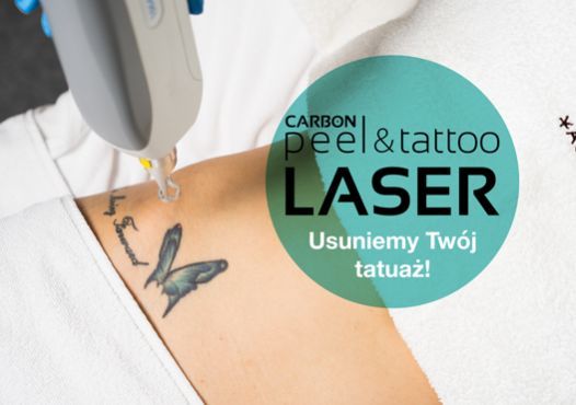 Portfolio usługi Laserowe usuwanie tatuażu Q-Switch
