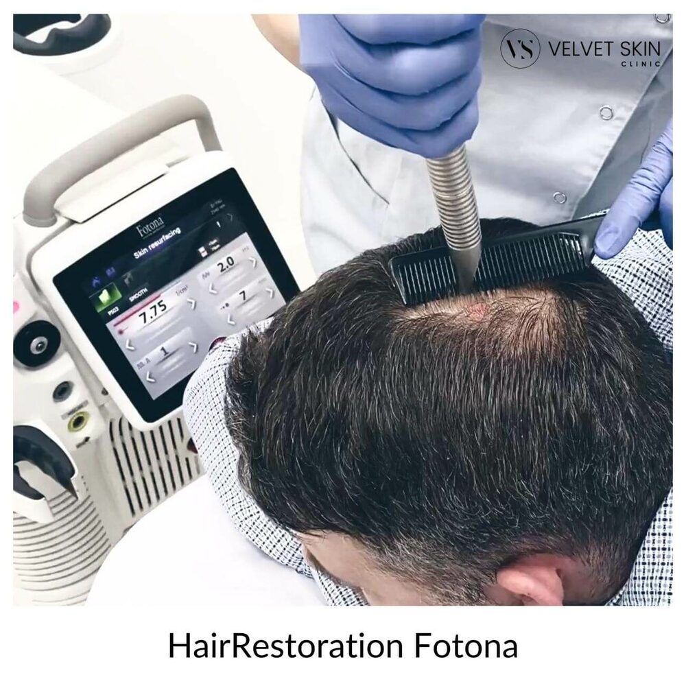 Portfolio usługi 💥 HairRestoration Fotona - laserowa stymulacja ...