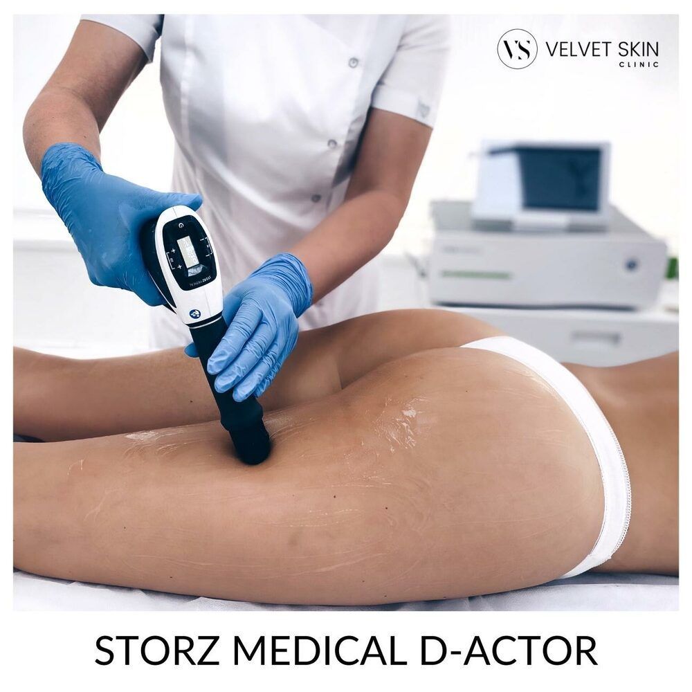 Portfolio usługi Fala akustyczna Storz Medical - głowica D-Actor