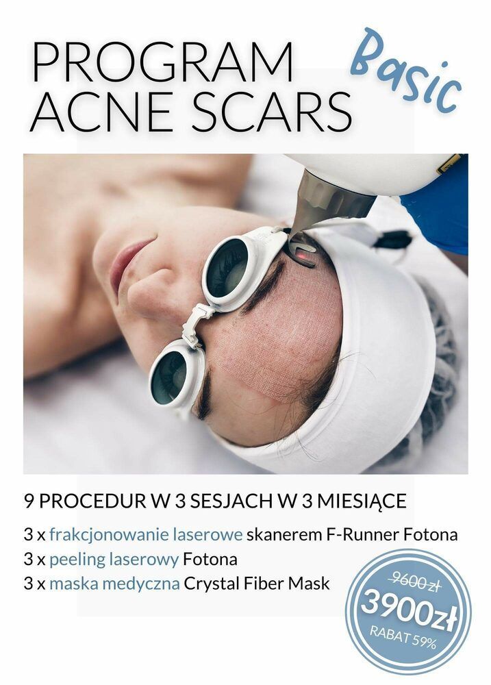 Portfolio usługi Program Acne Scars - BASIC