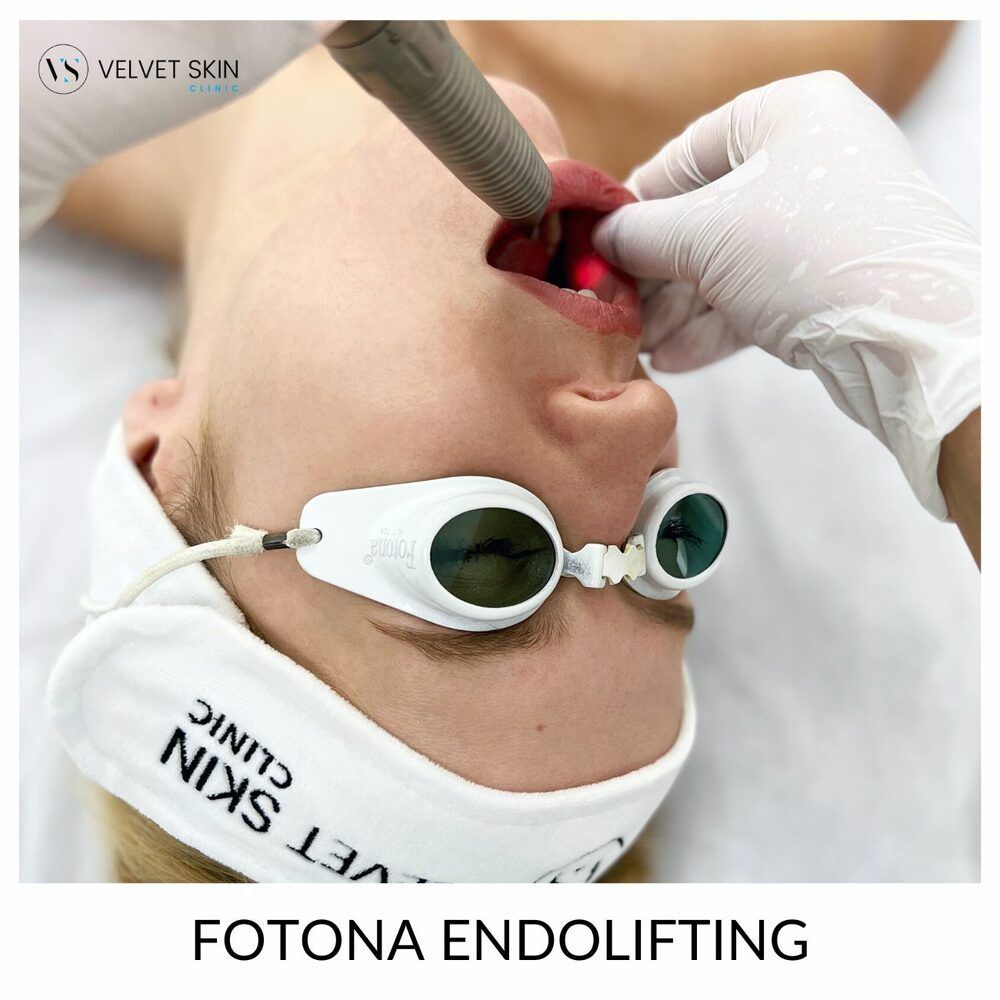 Portfolio usługi FOTONA - endolifting - laserowy lifting twarzy